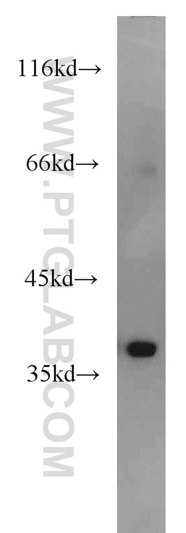 AIP/ARA9 Antibody in Western Blot (WB)