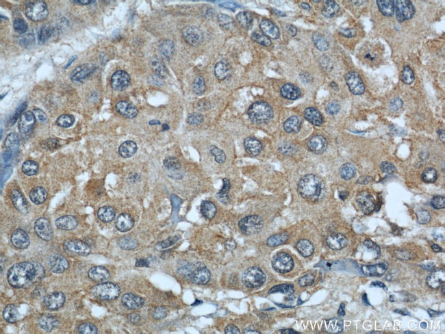 AIP/ARA9 Antibody in Immunohistochemistry (Paraffin) (IHC (P))