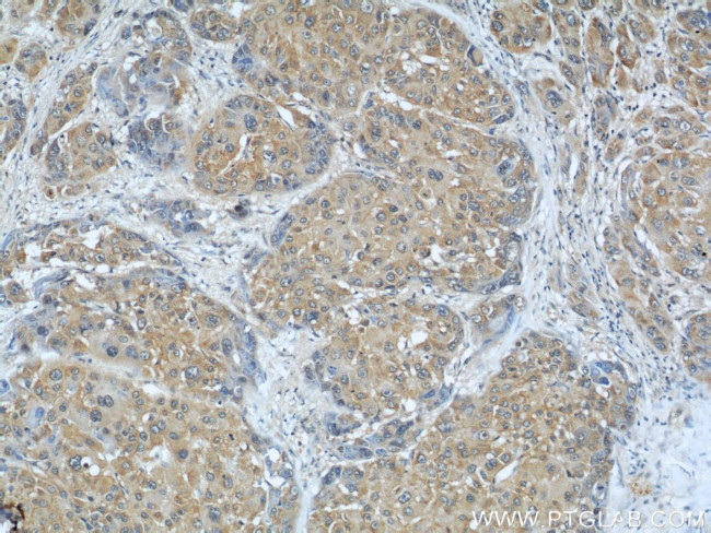 AIP/ARA9 Antibody in Immunohistochemistry (Paraffin) (IHC (P))