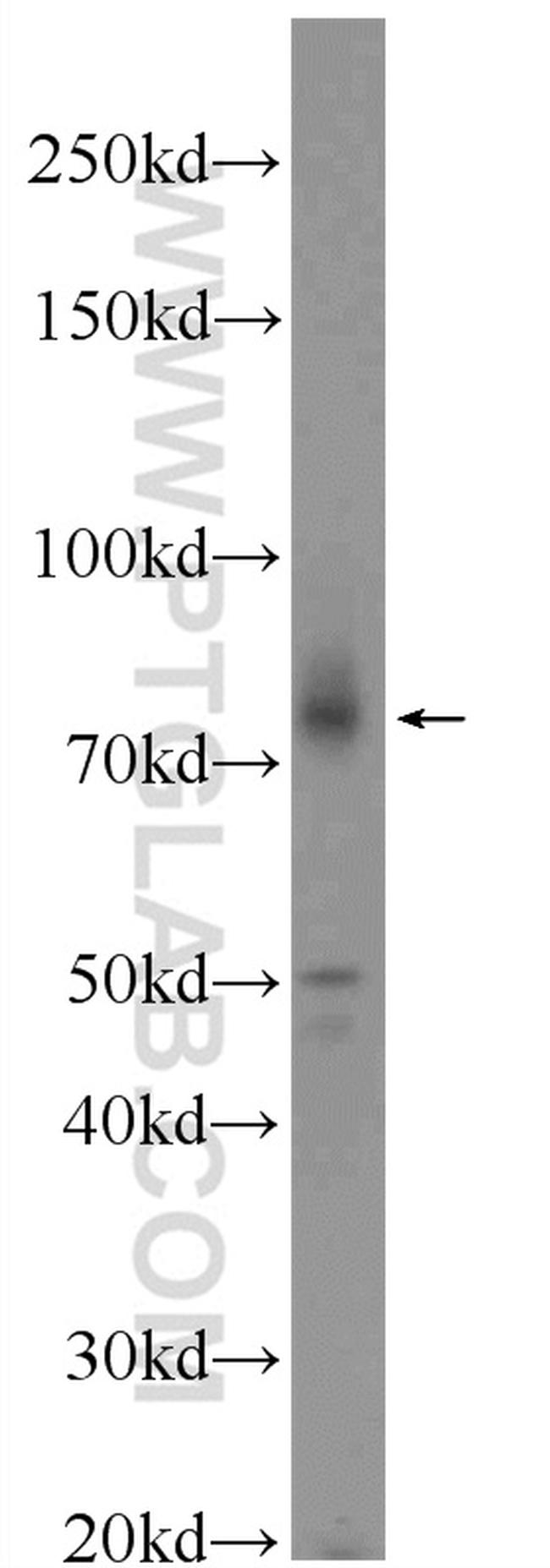 ABCD2 Antibody in Western Blot (WB)