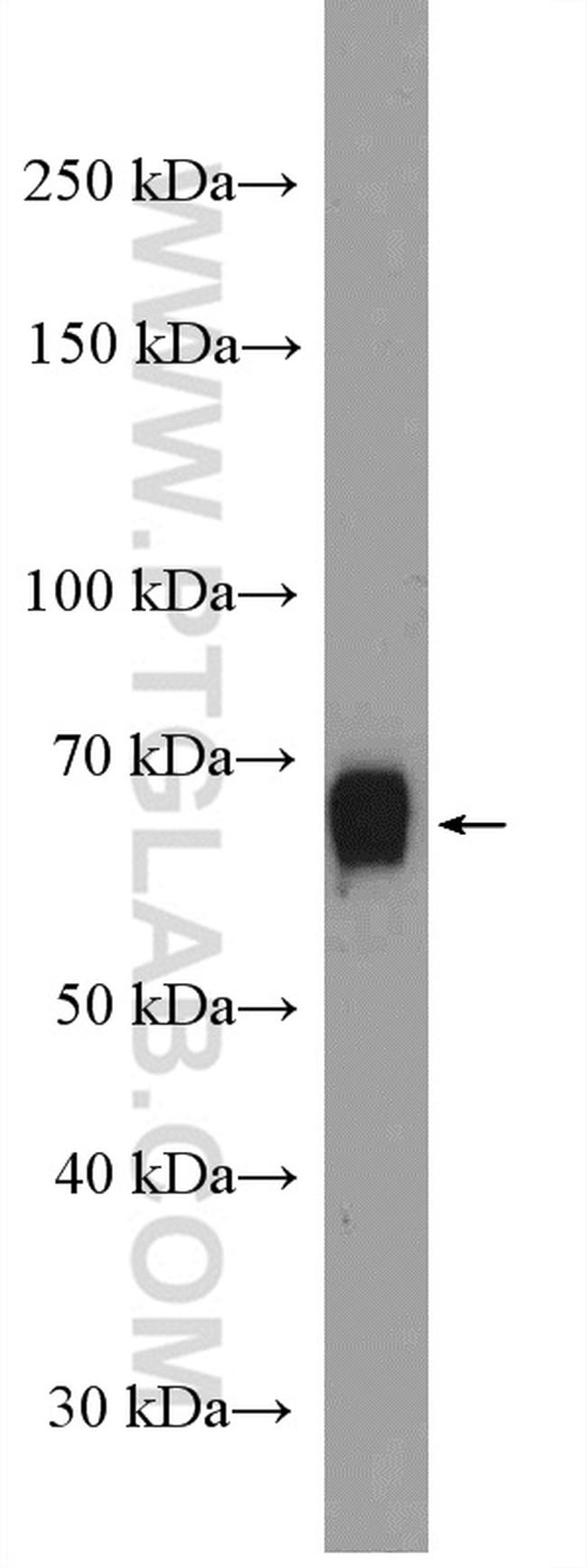 NOP56 Antibody in Western Blot (WB)