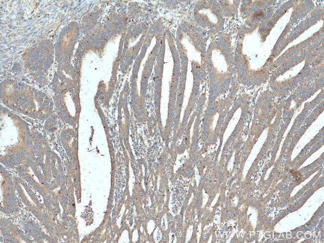 PAEP/Glycodelin Antibody in Immunohistochemistry (Paraffin) (IHC (P))