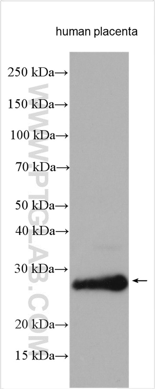 PAEP/Glycodelin Antibody in Western Blot (WB)