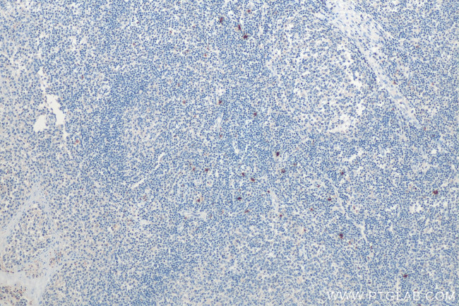 Mast Cell Chymase Antibody in Immunohistochemistry (Paraffin) (IHC (P))