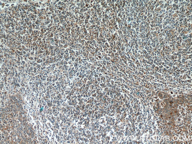 FUT7 Antibody in Immunohistochemistry (Paraffin) (IHC (P))