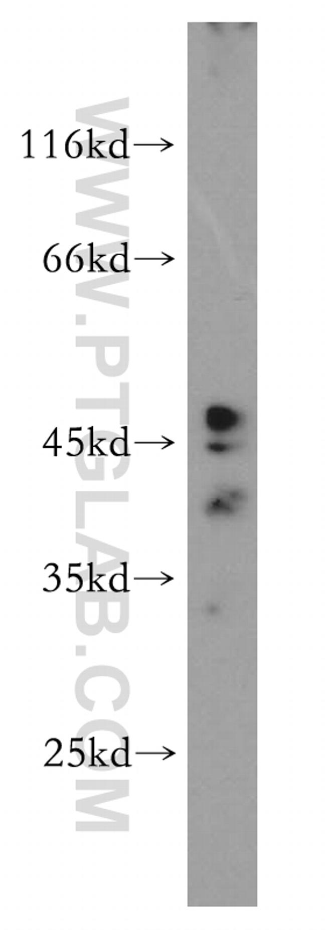 FUT7 Antibody in Western Blot (WB)