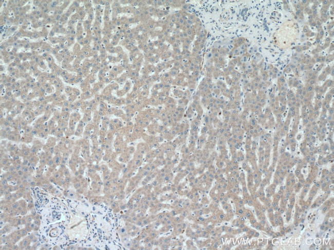 SHBG Antibody in Immunohistochemistry (Paraffin) (IHC (P))