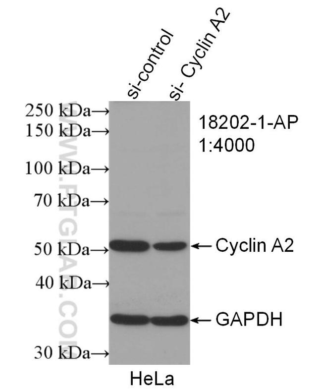 Cyclin A2 Antibody in Western Blot (WB)