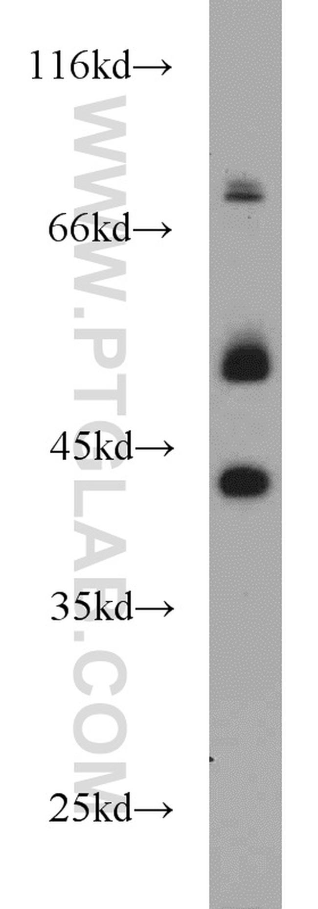 PBX1 Antibody in Western Blot (WB)