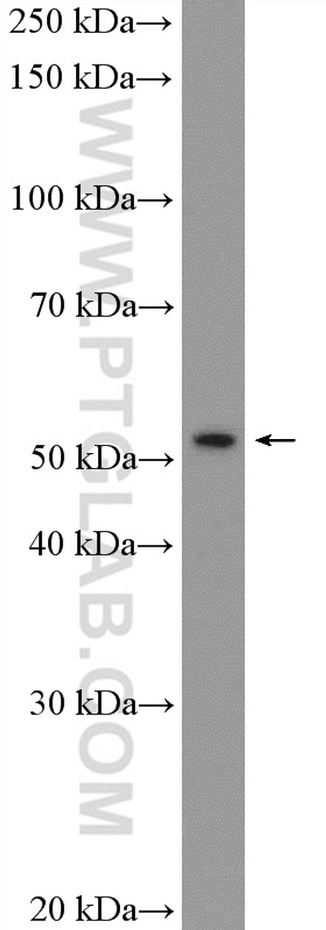 PBX1 Antibody in Western Blot (WB)