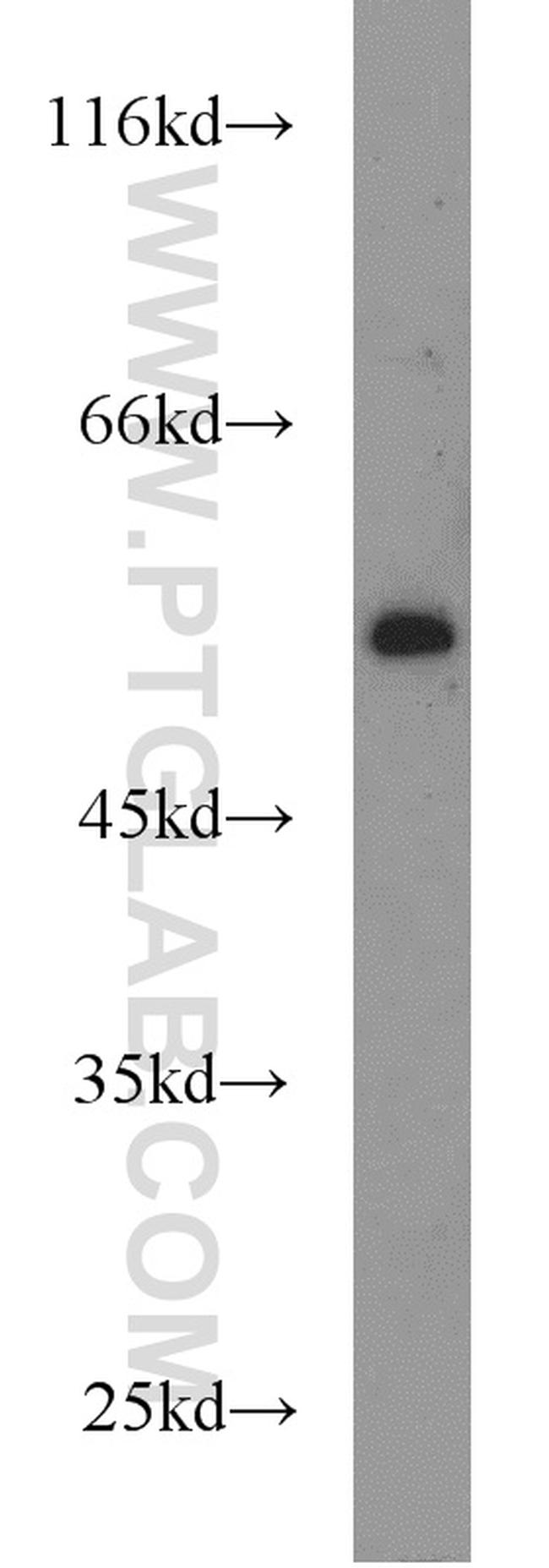 PBX1 Antibody in Western Blot (WB)