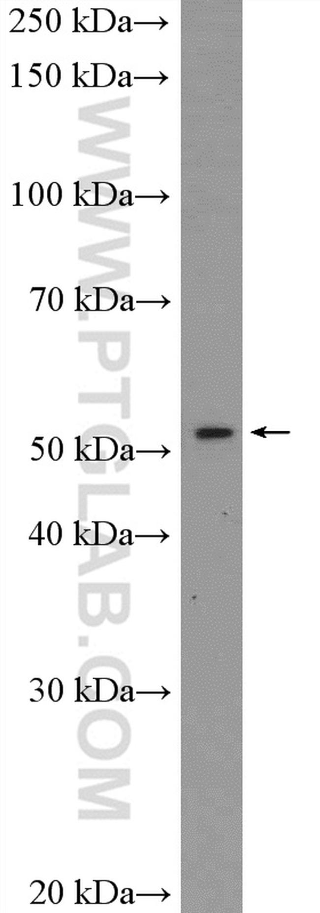 PBX1 Antibody in Western Blot (WB)