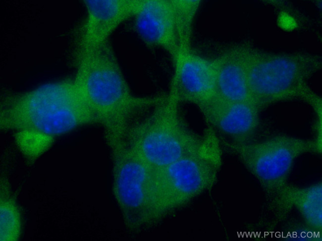 Dynamin 1 Antibody in Immunocytochemistry (ICC/IF)