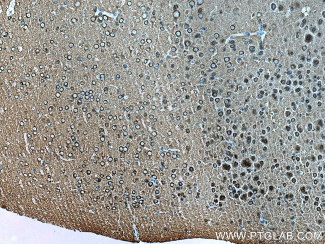 Dynamin 1 Antibody in Immunohistochemistry (Paraffin) (IHC (P))