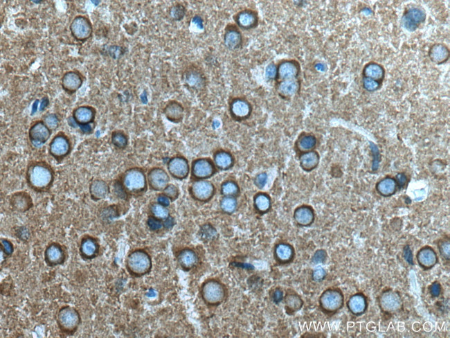 Dynamin 1 Antibody in Immunohistochemistry (Paraffin) (IHC (P))