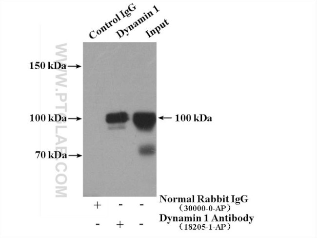 Dynamin 1 Antibody in Immunoprecipitation (IP)