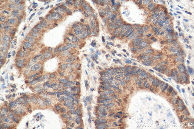 CCL28 Antibody in Immunohistochemistry (Paraffin) (IHC (P))