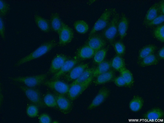 RPS9 Antibody in Immunocytochemistry (ICC/IF)