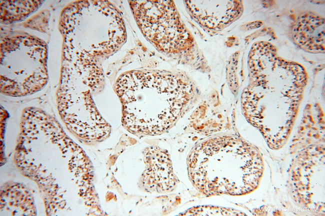 RPS9 Antibody in Immunohistochemistry (Paraffin) (IHC (P))