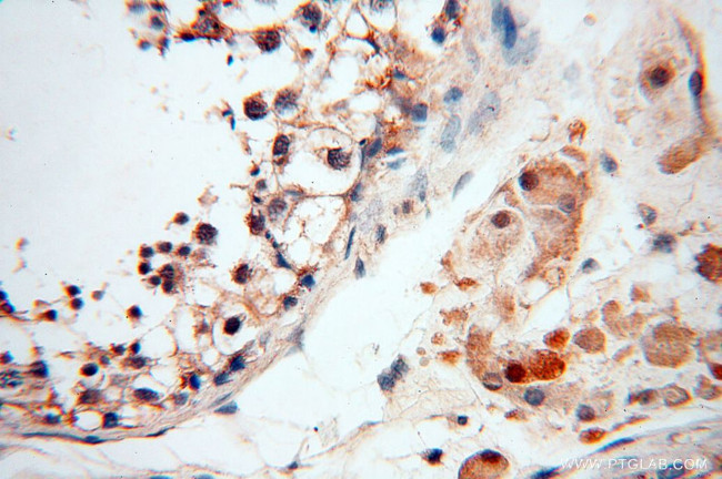 RPS9 Antibody in Immunohistochemistry (Paraffin) (IHC (P))