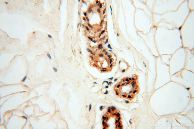 RPS9 Antibody in Immunohistochemistry (Paraffin) (IHC (P))