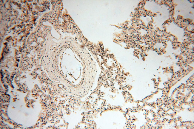 RPS9 Antibody in Immunohistochemistry (Paraffin) (IHC (P))