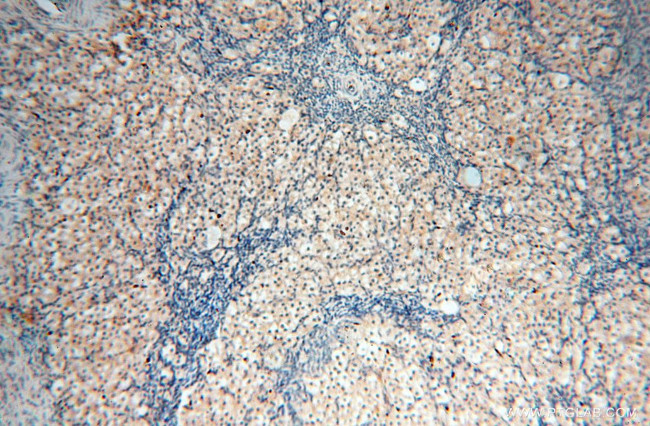 RPS9 Antibody in Immunohistochemistry (Paraffin) (IHC (P))