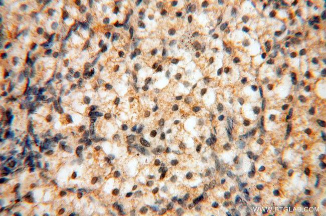 RPS9 Antibody in Immunohistochemistry (Paraffin) (IHC (P))