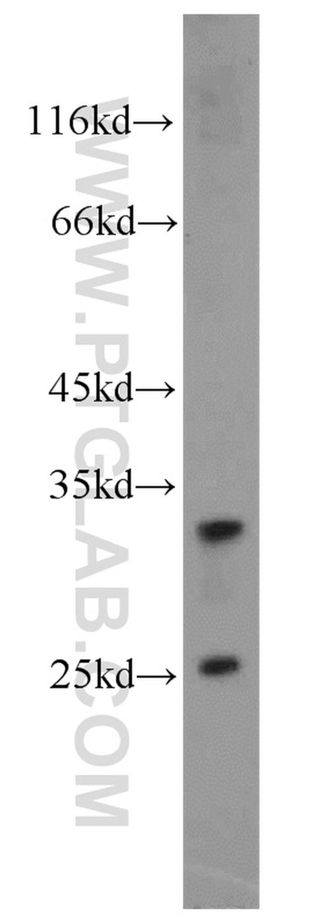 RPS9 Antibody in Western Blot (WB)