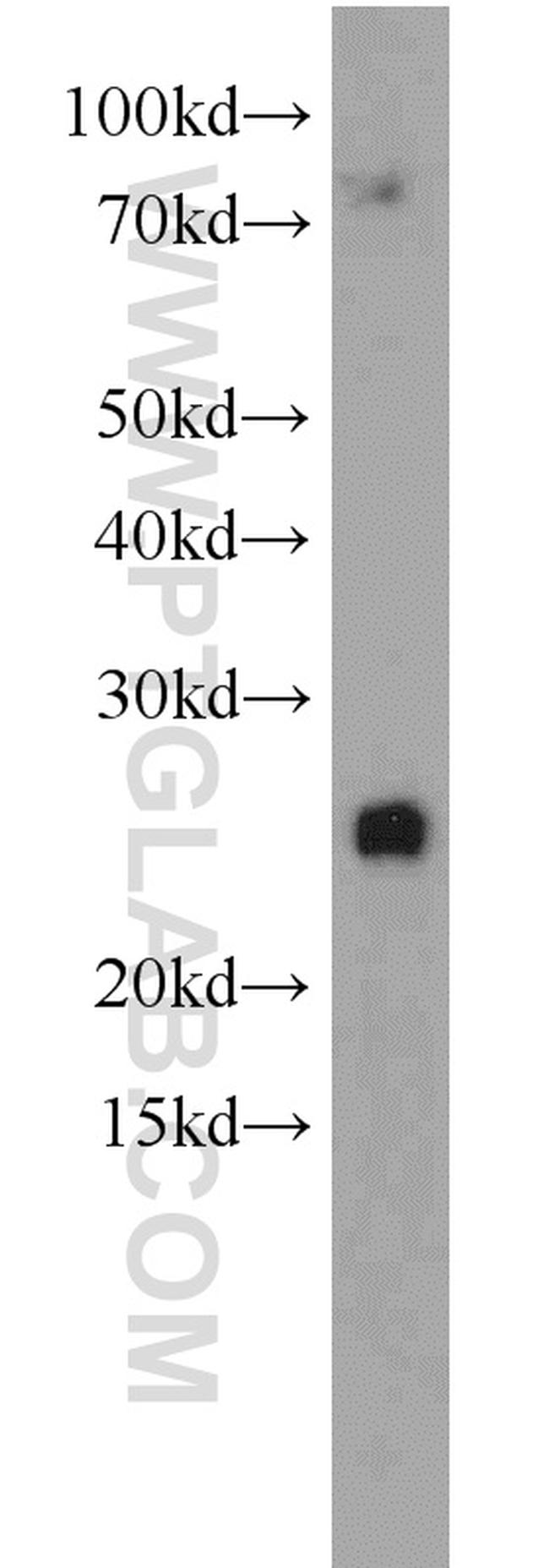 RPS9 Antibody in Western Blot (WB)