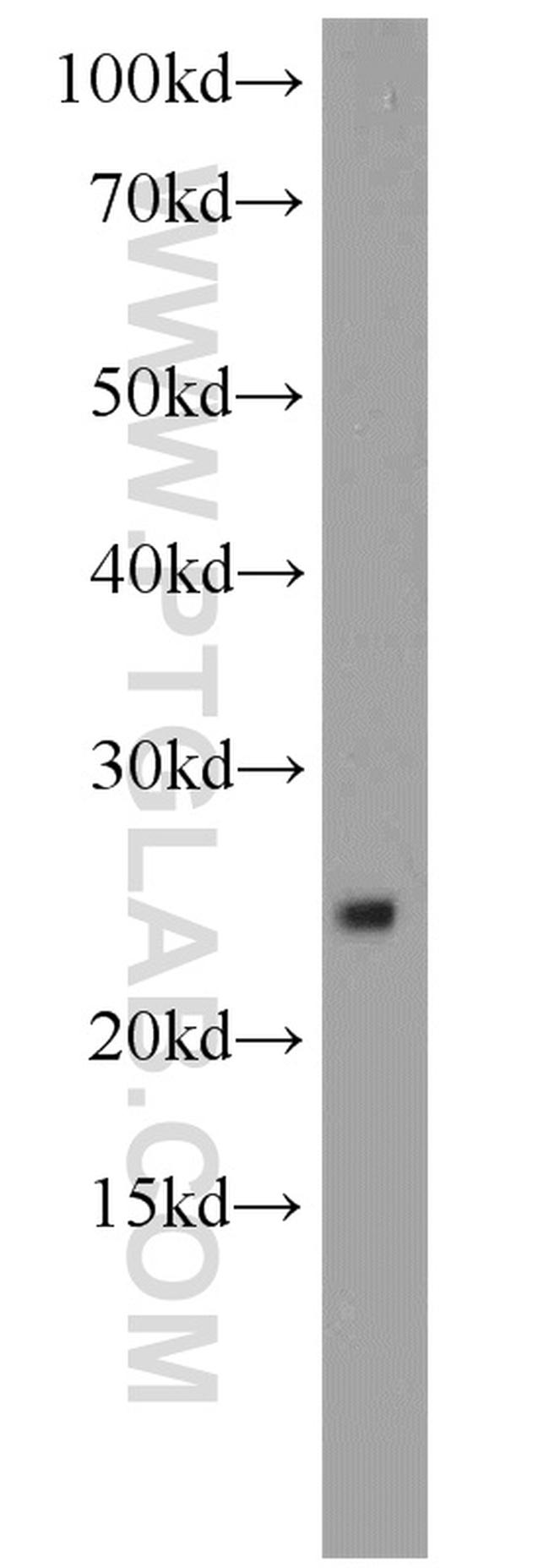RPS9 Antibody in Western Blot (WB)
