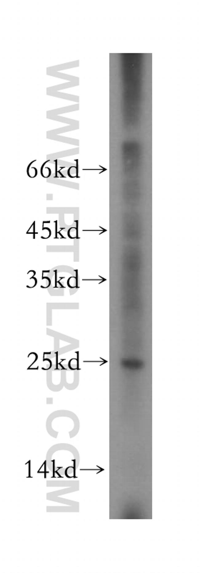 RPS9 Antibody in Western Blot (WB)