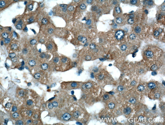 LSR Antibody in Immunohistochemistry (Paraffin) (IHC (P))