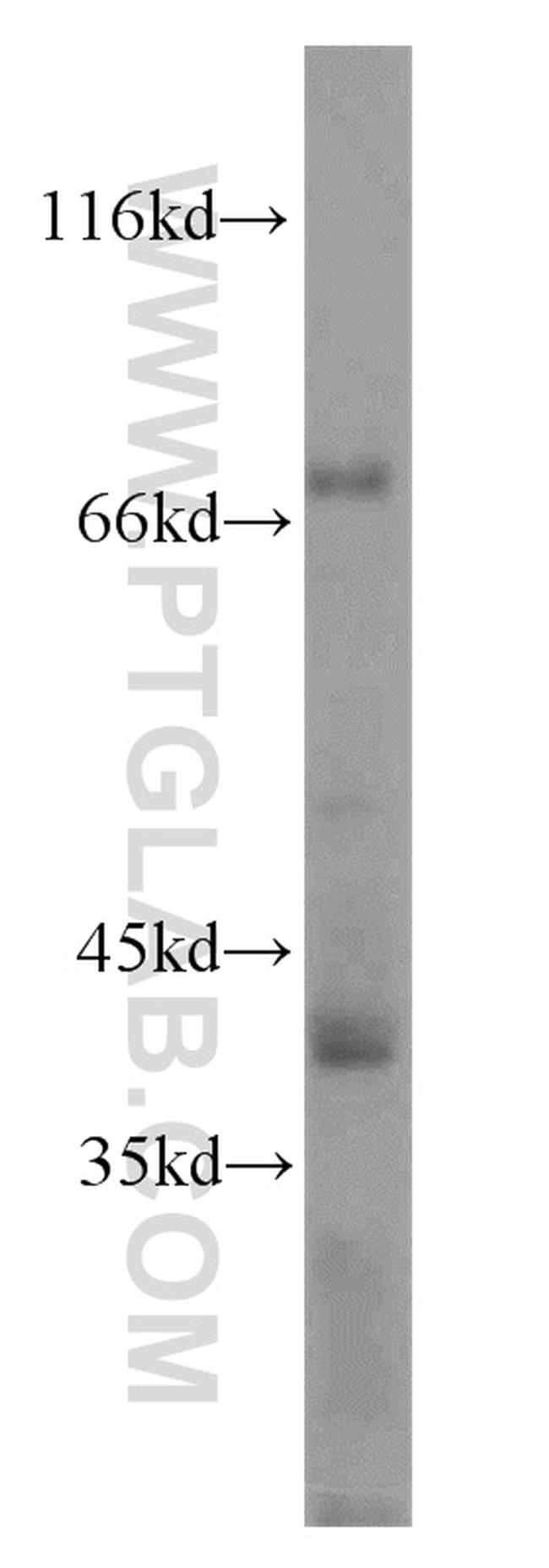 LSR Antibody in Western Blot (WB)