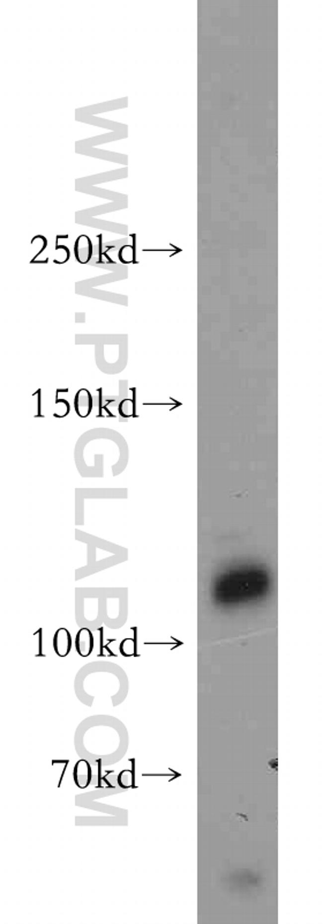 SHROOM1 Antibody in Western Blot (WB)