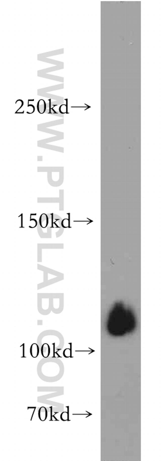 SHROOM1 Antibody in Western Blot (WB)