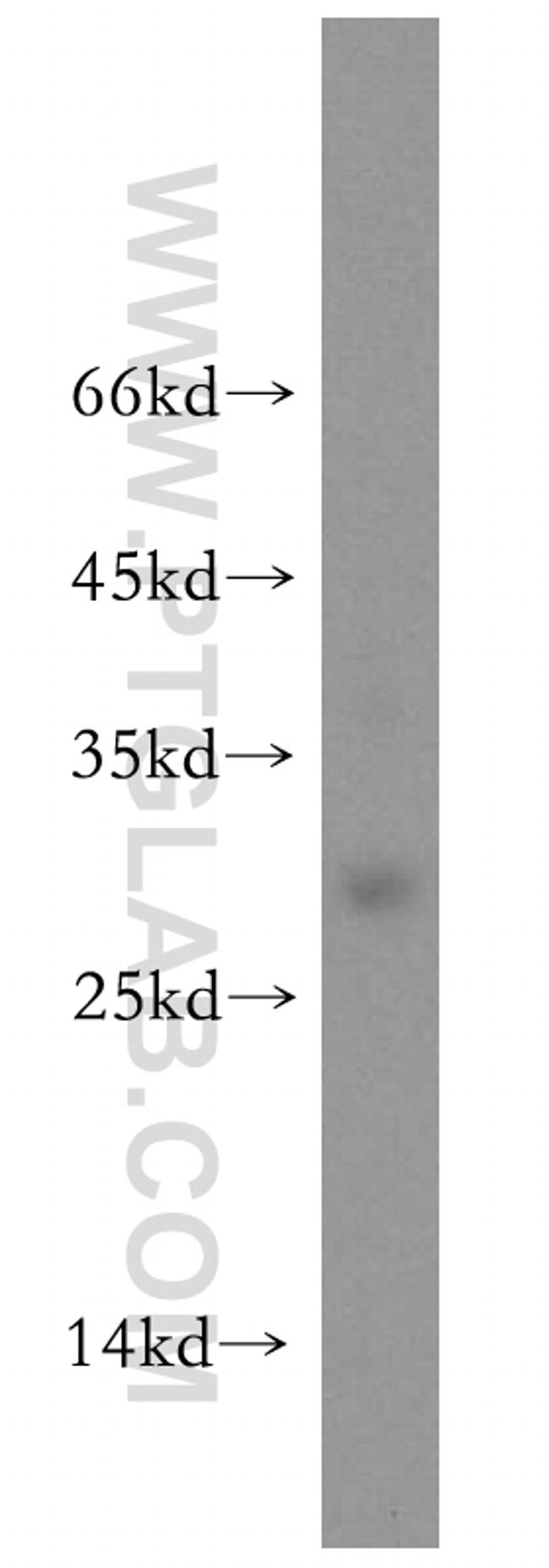 UBE2S Antibody in Western Blot (WB)