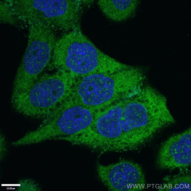 IkB alpha Antibody in Immunocytochemistry (ICC/IF)