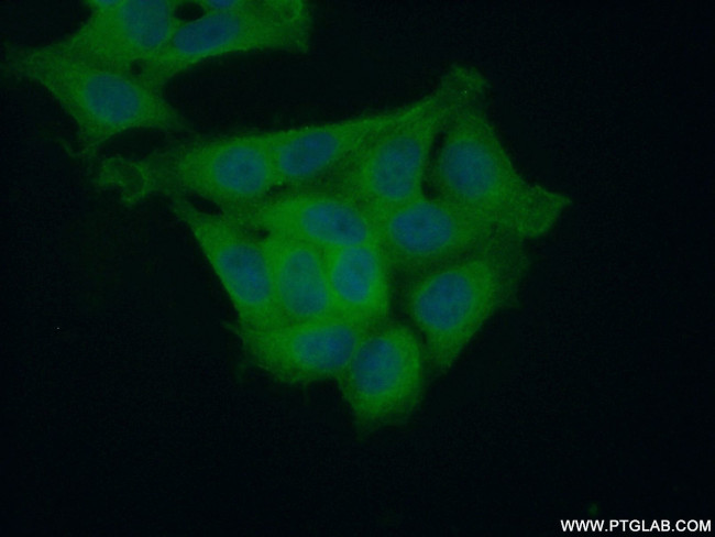 IkB alpha Antibody in Immunocytochemistry (ICC/IF)