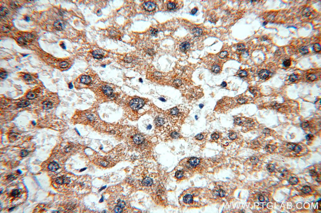 IkB alpha Antibody in Immunohistochemistry (Paraffin) (IHC (P))