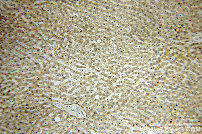 IkB alpha Antibody in Immunohistochemistry (Paraffin) (IHC (P))