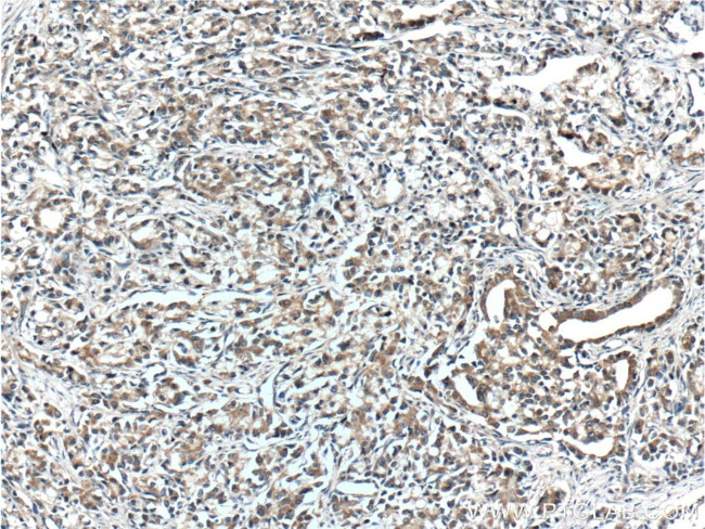 IkB alpha Antibody in Immunohistochemistry (Paraffin) (IHC (P))