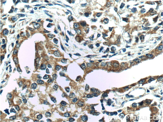 IkB alpha Antibody in Immunohistochemistry (Paraffin) (IHC (P))