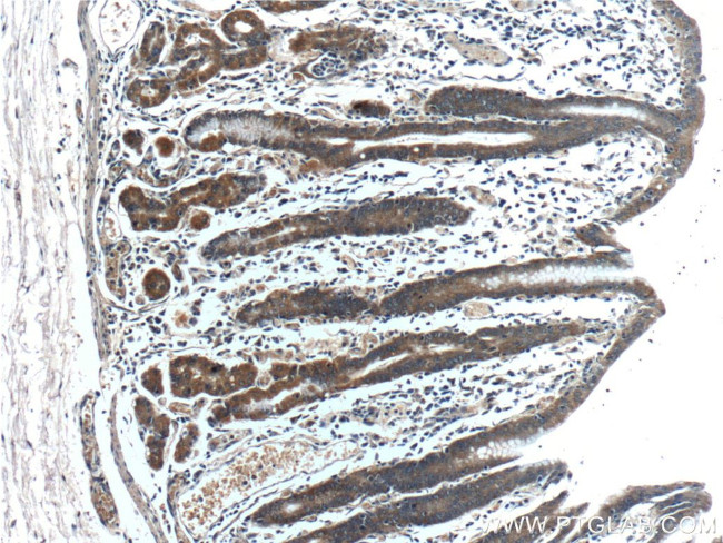 IkB alpha Antibody in Immunohistochemistry (Paraffin) (IHC (P))