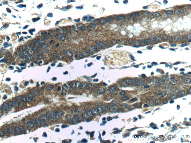 IkB alpha Antibody in Immunohistochemistry (Paraffin) (IHC (P))