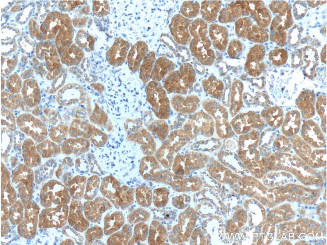 IkB alpha Antibody in Immunohistochemistry (Paraffin) (IHC (P))