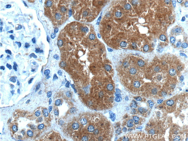 IkB alpha Antibody in Immunohistochemistry (Paraffin) (IHC (P))