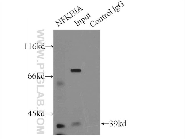 IkB alpha Antibody in Immunoprecipitation (IP)