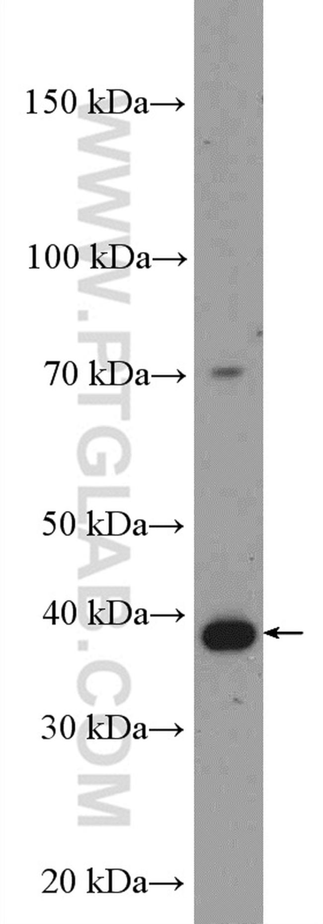 IkB alpha Antibody in Western Blot (WB)