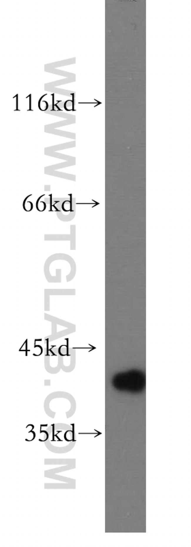 IkB alpha Antibody in Western Blot (WB)